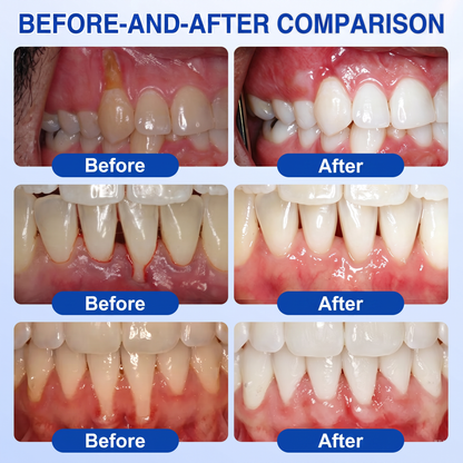 🦷  periodontal repair gel 🧑‍⚕️