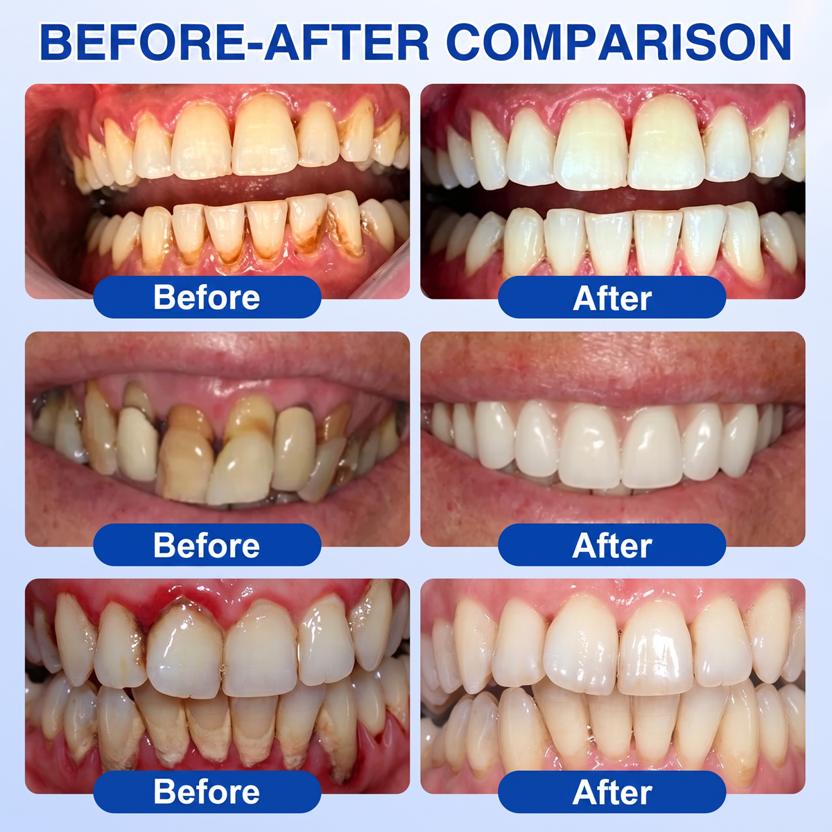 🦷  periodontal repair gel 🧑‍⚕️
