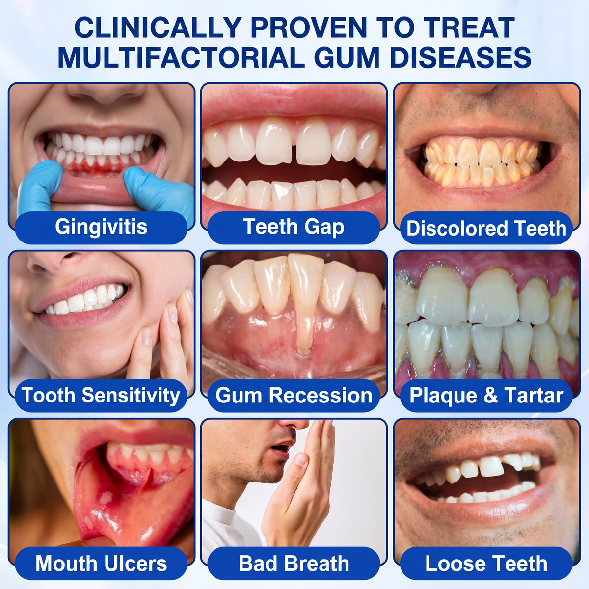 🦷  periodontal repair gel 🧑‍⚕️