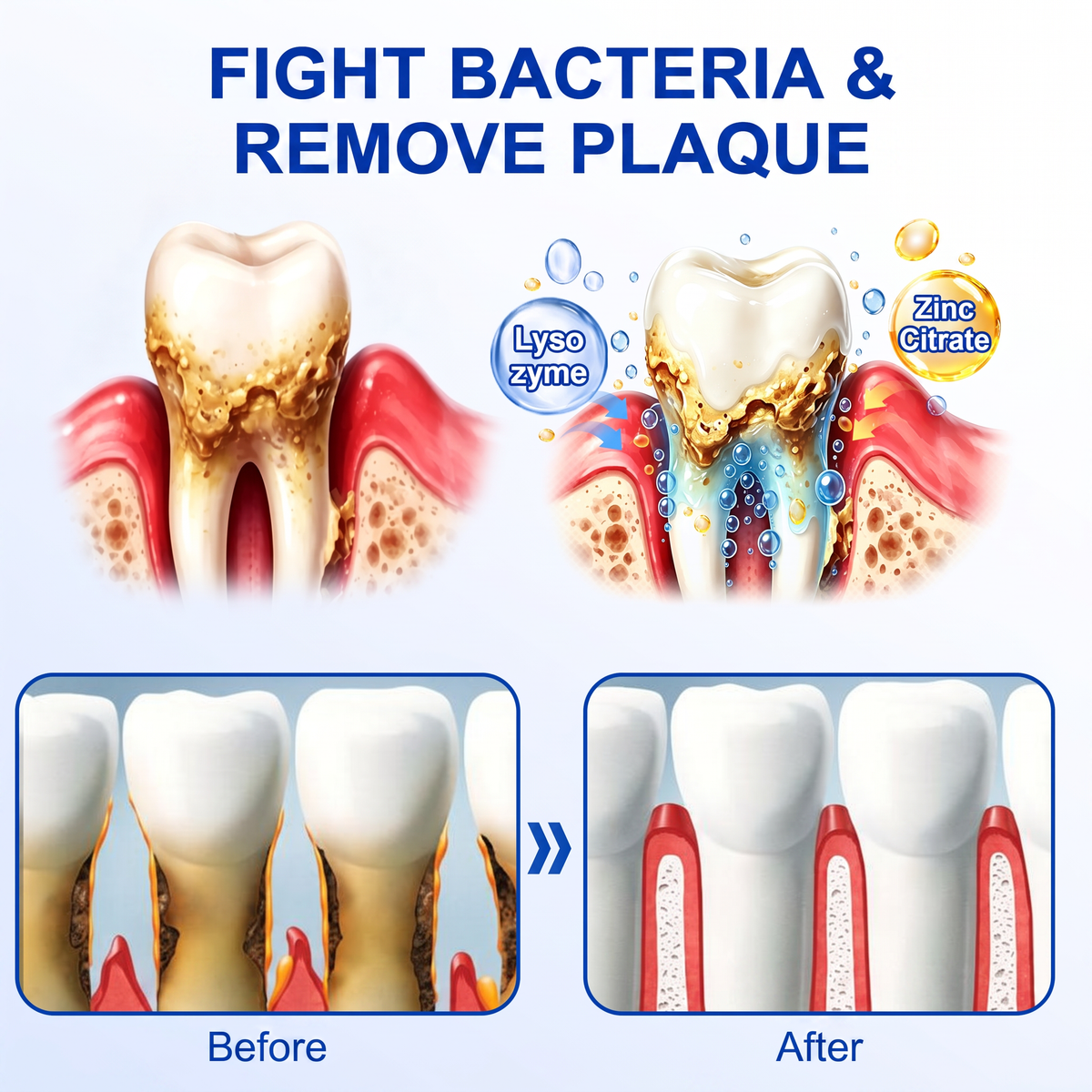 🦷  periodontal repair gel 🧑‍⚕️