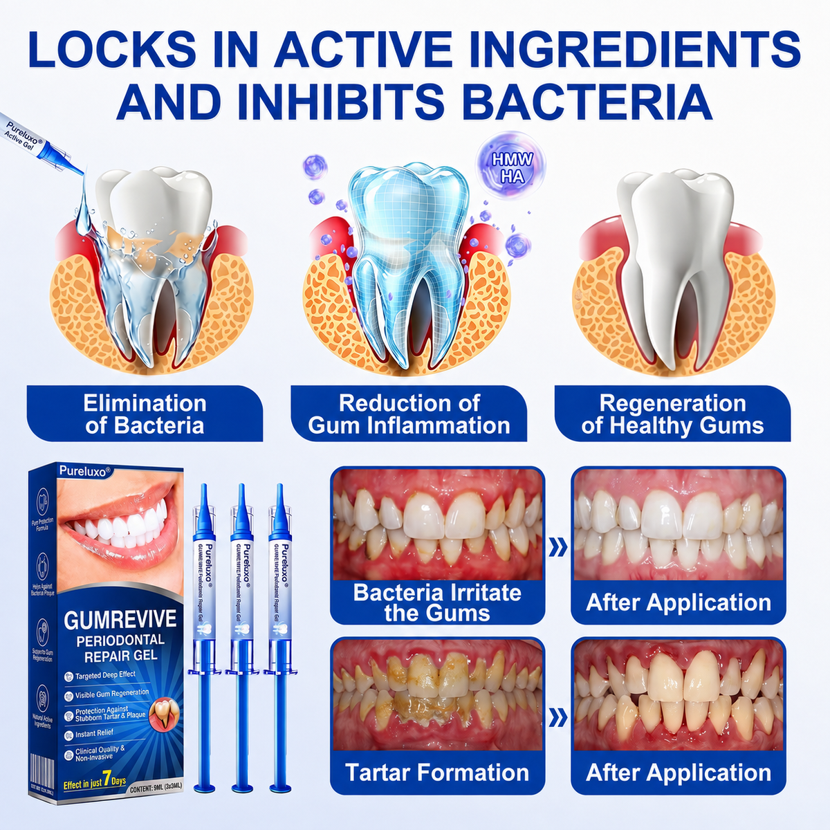🦷  periodontal repair gel 🧑‍⚕️