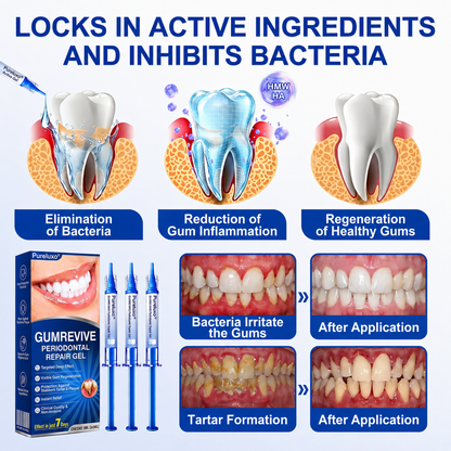 🦷  periodontal repair gel 🧑‍⚕️